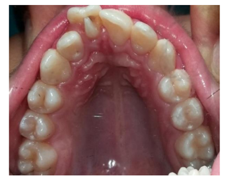 Tongue hotsell a talon